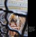 Vatican047